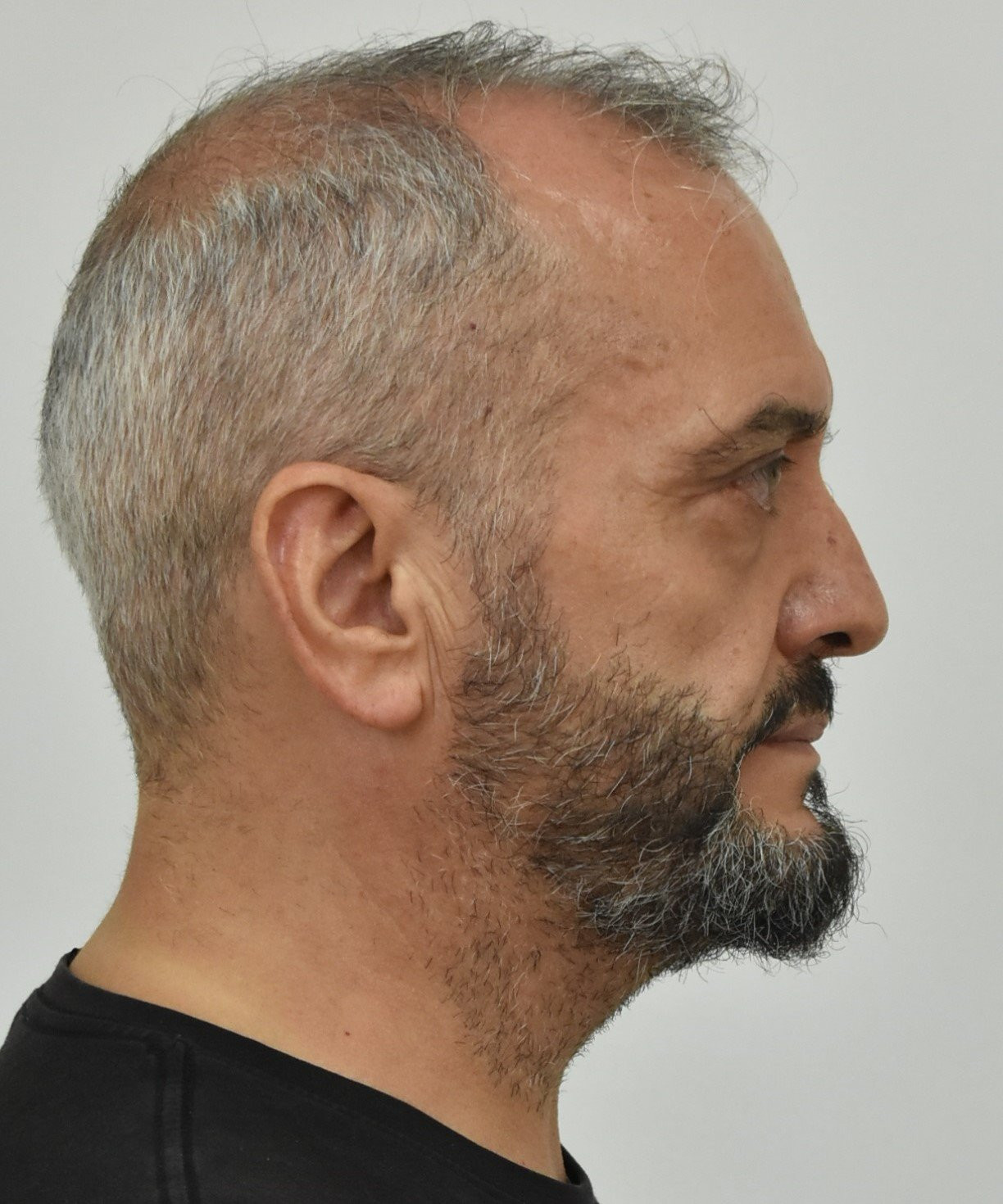ΜΙΧΟΣ