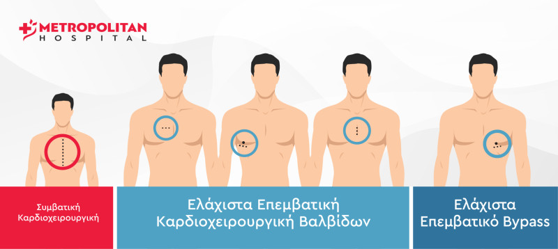 kardioxeirourgiki Metropolitan