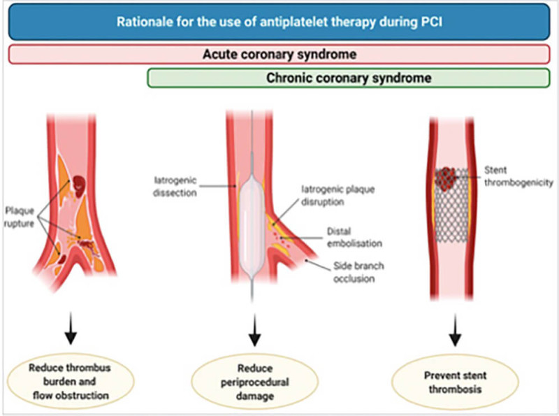 kardia Metropolitan stefaniaia nosos