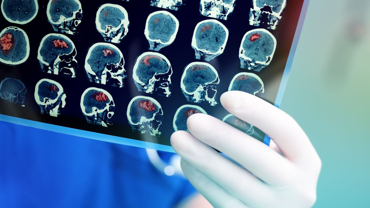 Ιατρικό θαύμα: 13χρονο αγόρι θεραπεύτηκε από θανατηφόρο καρκίνο του εγκεφάλου