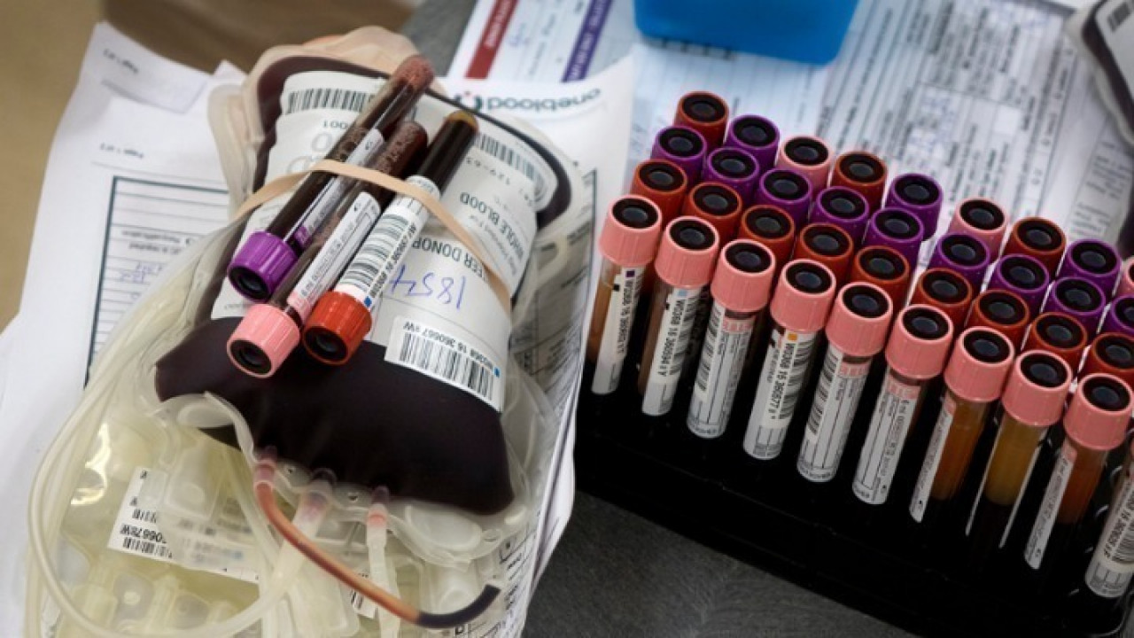 Αλλαγές στη διαχείριση μονάδων αίματος- Το σχέδιο της κυβέρνησης