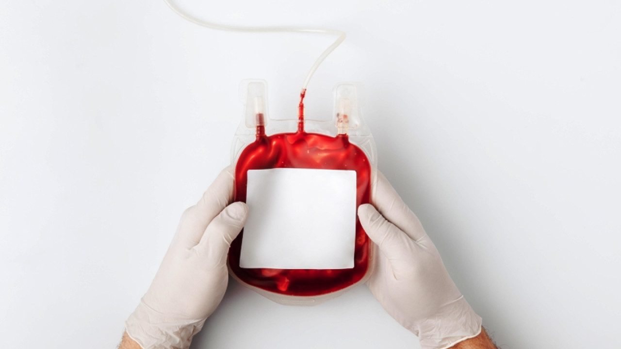 Μεσογειακή Αναιμία: Γονιδιακή θεραπεία απάλλαξε ασθενή από τις μεταγγίσεις