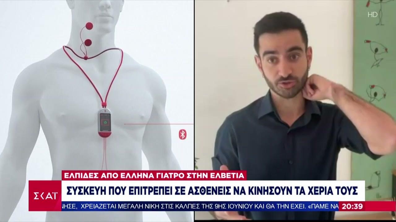 Ελβετία: Συσκευή επιτρέπει σε ασθενείς να κινήσουν τα χέρια τους - Τι δηλώνει Έλληνας γιατρός