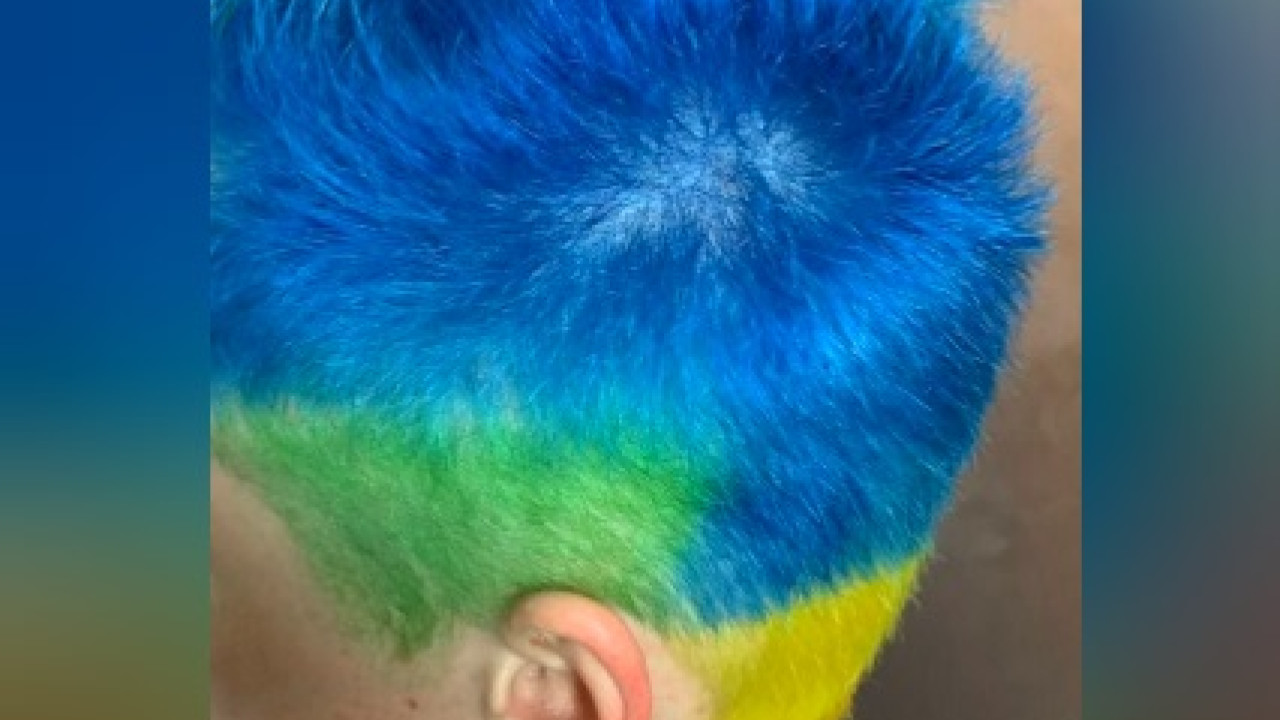 Ρωσία: Πρόστιμο σε νεαρό - Έβαψε τα μαλλιά του -σχεδόν- στα χρώματα της Ουκρανίας