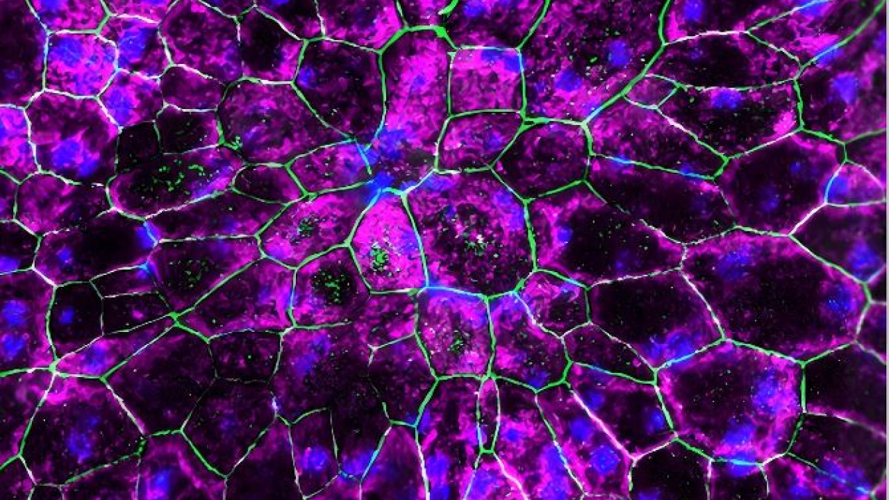 Επαναστατική θεραπεία για την ηλικιακή εκφύλιση της ωχράς κηλίδας