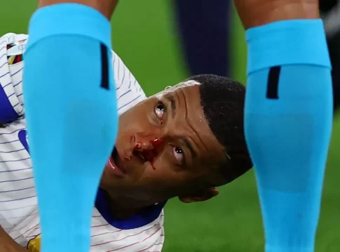 O Κιλιάν Εμπαπέ χάνει το Γαλλία – Ολλανδία για τη δεύτερη αγωνιστική του Euro 2024