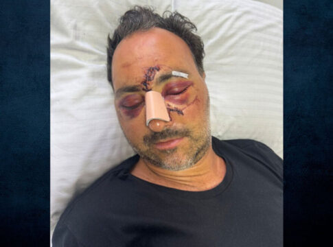 Ηράκλειο: Eπιστολή στον Υπουργό Δικαιοσύνης από τον δικηγόρο του Ελληνοκαναδού που ξυλοκοπήθηκε άγρια