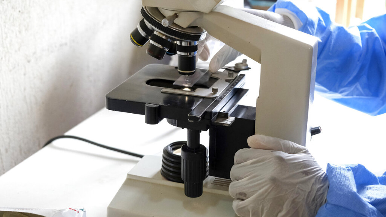 Ανησυχία για την αύξηση καρκίνων σε νεαρές ηλικίες - Τι συμβαίνει στις γυναίκες