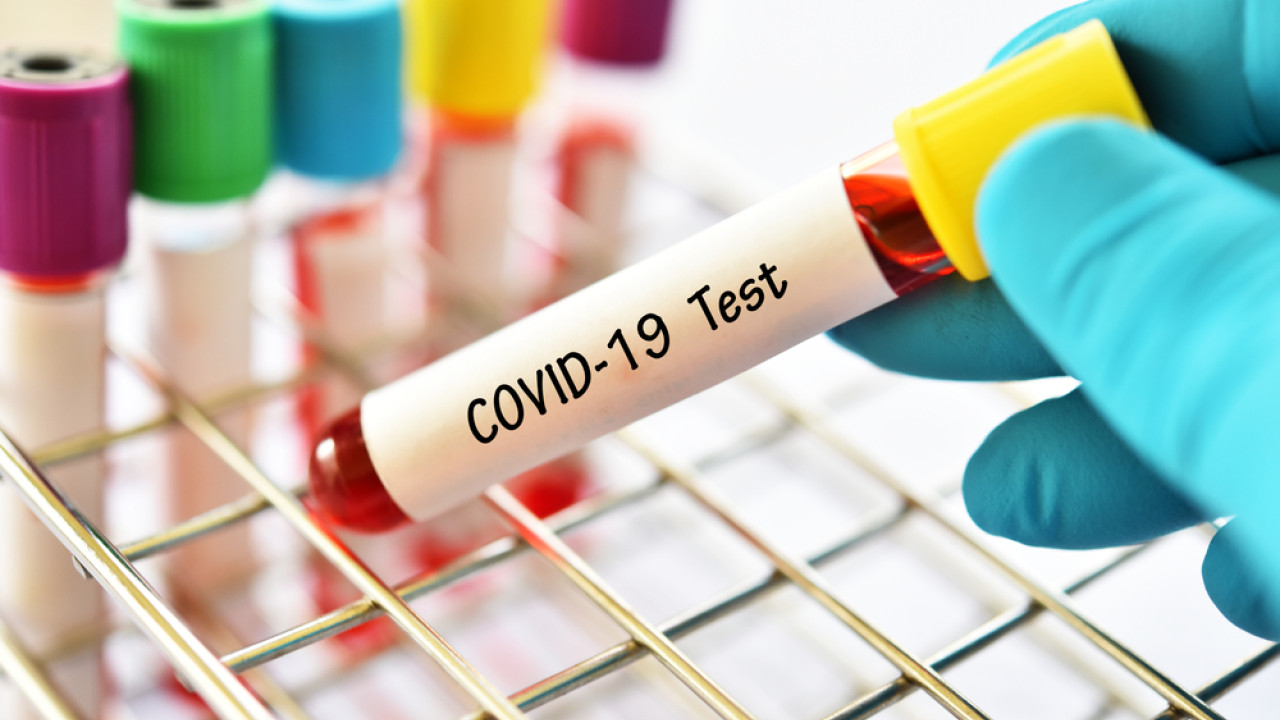 Κορωνοϊός: 709 εισαγωγές, 4 διασωληνωμένοι και 28 θάνατοι την τελευταία εβδομάδα