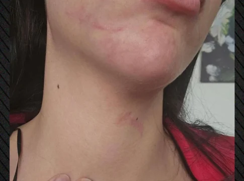 Εφιάλτης στην Έδεσσα για 29χρονη Ηρακλειώτισσα – Στο εδώλιο ο 34χρονος σύντροφός της που την ξυλοκόπησε