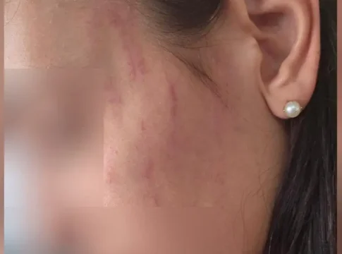 Σοκαριστικό βίντεο ντοκουμέντο από τον ξυλοδαρμό της 29χρονης Ηρακλειώτισσας από τον σύντροφό της