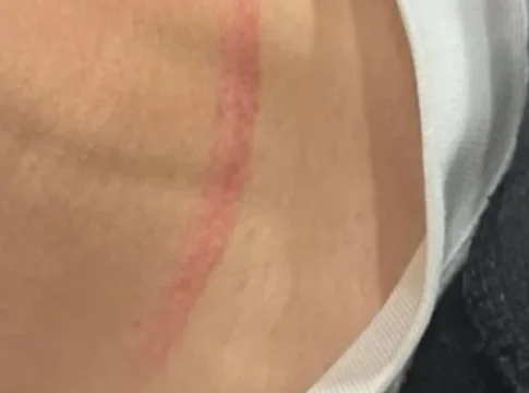 Tρόμος για γιο Ηρακλειώτη ηθοποιού – Συμμορία ανηλίκων του άρπαξε αλυσίδα από το λαιμό