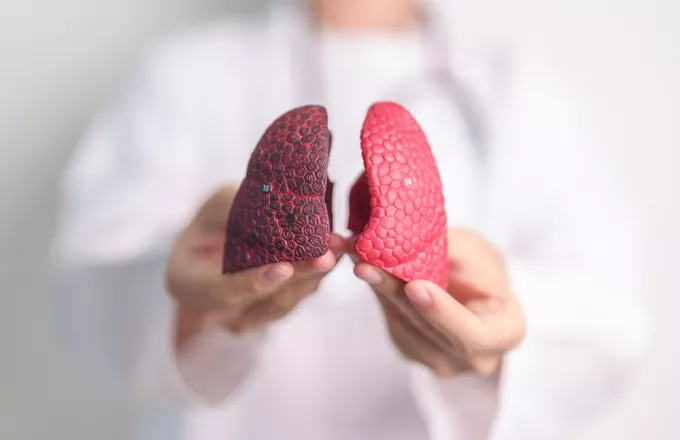 Καρκίνος πνεύμονα