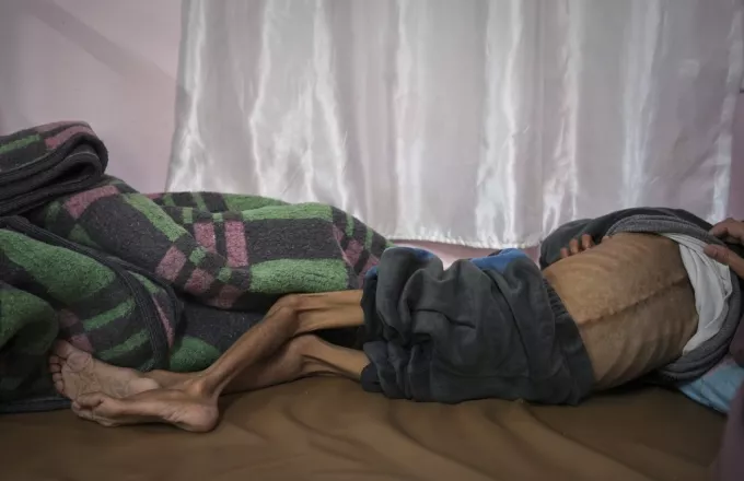 Σκελετωμένος ασθενής Γάζας