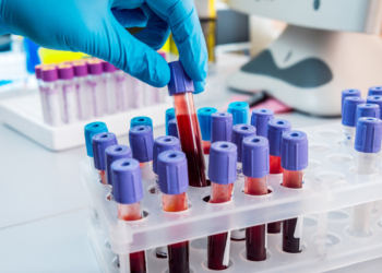 Ηλεκτρονικά παραπεμπτικά: Όλα έχουν ημερομηνία λήξεως 60 ημερών