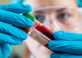 Καρκίνος παγκρέατος: Εργαλείο για την πρόληψή του αναπτύσσουν ελληνικά εργαστήρια