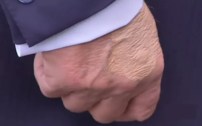ΤΡΑΜΠ
