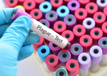 Κάτοικος της Καλιφόρνιας βρέθηκε θετικός στην πανώλη