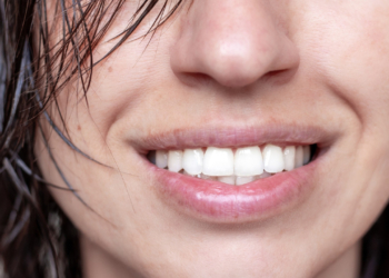 Κερατίνη από μαλλί προβάτων επιδιορθώνει τα δόντια