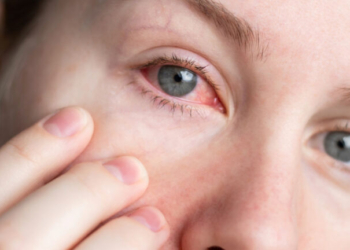 Νόσος Sjögren: Το «άγνωστο» αυτοάνοσο και πώς επηρεάζει τους ασθενείς