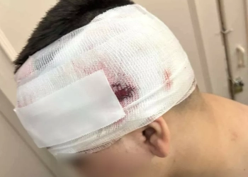 Άγριος ξυλοδαρμός 13χρονου από νεαρούς στη Θεσσαλονίκη