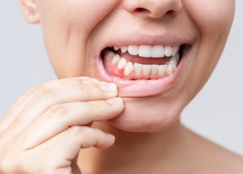 Μεσογειακή διατροφή: Κάνει καλό στα ούλα