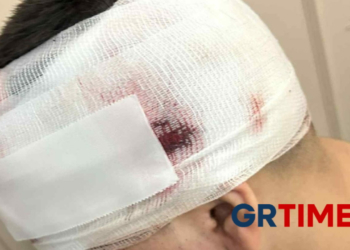 Θεσσαλονίκη: 11 άτομα επιτέθηκαν στον 13χρονο – Συνελήφθη 18χρονος