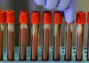 2η Εθελοντική αιμοδοσία από την ΕΤΑΝΑΠ ΣΑΜΑΡΙΑ