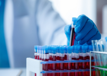 Μια εξέταση αίματος μπορεί να ανιχνεύσει 50 τύπους καρκίνου