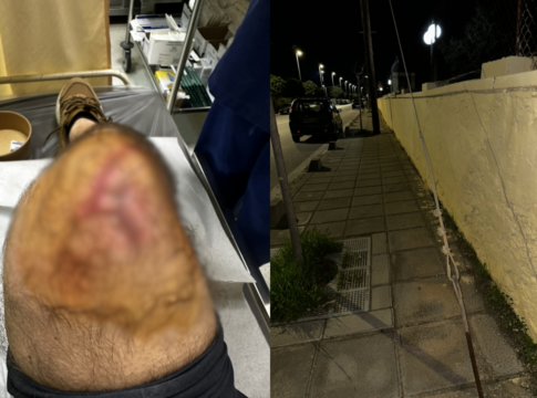 Ηράκλειο: Από το πεζοδρόμιο-παγίδα στο νοσοκομείο πολίτης – Καμία παρέμβαση μετά τον σοβαρό τραυματισμό του