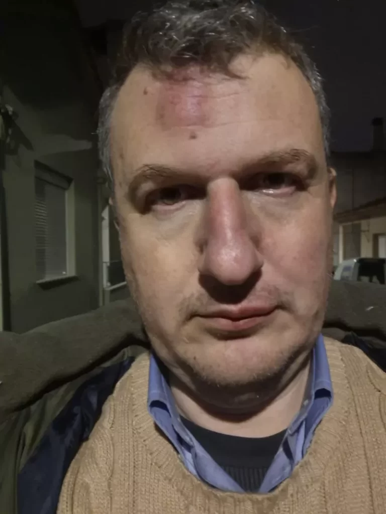 Θύμα άγριου ξυλοδαρμού ο εκδότης της εφημερίδας «Μαγνησία» στον Βόλο - «Οι τραμπουκισμοί δεν μας πτοούν»