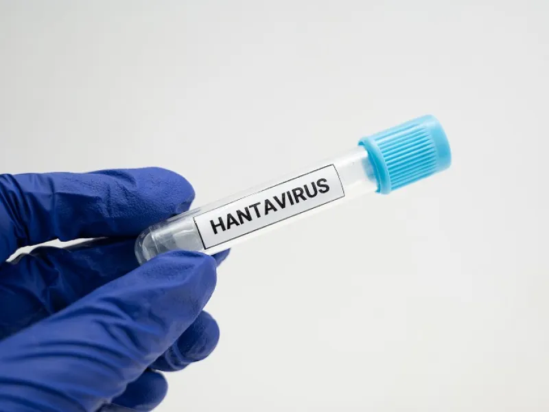 Δοκιμαστικός σωλήνας Hantavirus