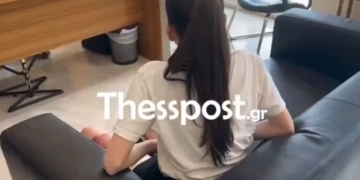 Θεσσαλονίκη: 20χρονη μπήκε για επέμβαση σε νοσοκομείο κι έφυγε με εγκαύματα τρίτου βαθμού