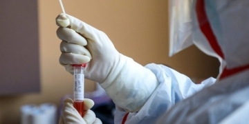 Ξεπέρασαν τις 3.500 τα κρούσματα έμπολα στη ΛΔ Κονγκό